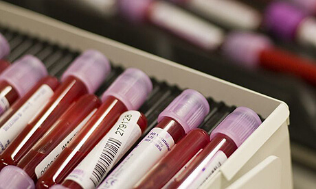 blood test
