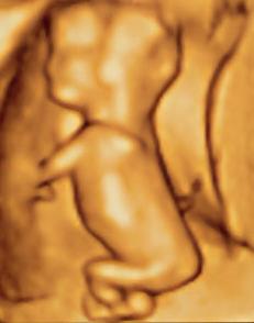 ultrasound