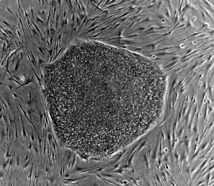 px Human embryonic stem cell colony phase