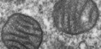 Mitochondria mammalian lung TEM