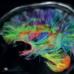 brain