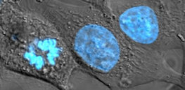 HeLa cells stained with Hoechst