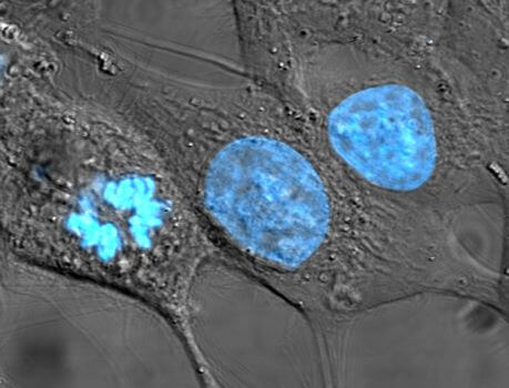 HeLa cells stained with Hoechst