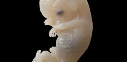 Human embryo e
