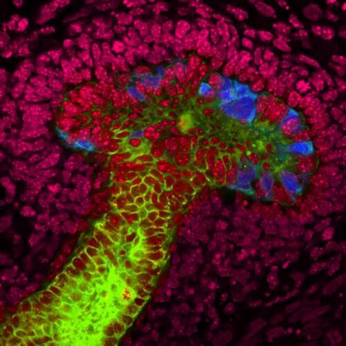 Scientists grow 'mini-kidneys' from human stem cells - Genetic Literacy ...