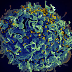 hiv infected full