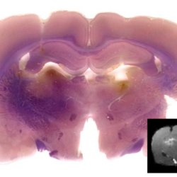 SecondaryNewsImage MolecularMRI