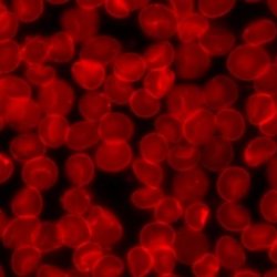 Sedimented red blood cells