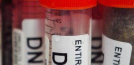 dna samping