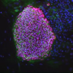 stemcell