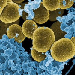 px Staphylococcus aureus bacteria escape