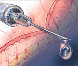 stemcell