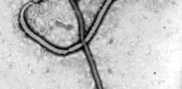 px Ebola virus em