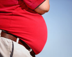 obese man