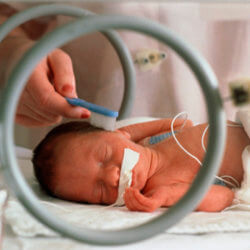 preterm birth