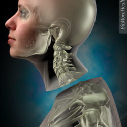 severed head