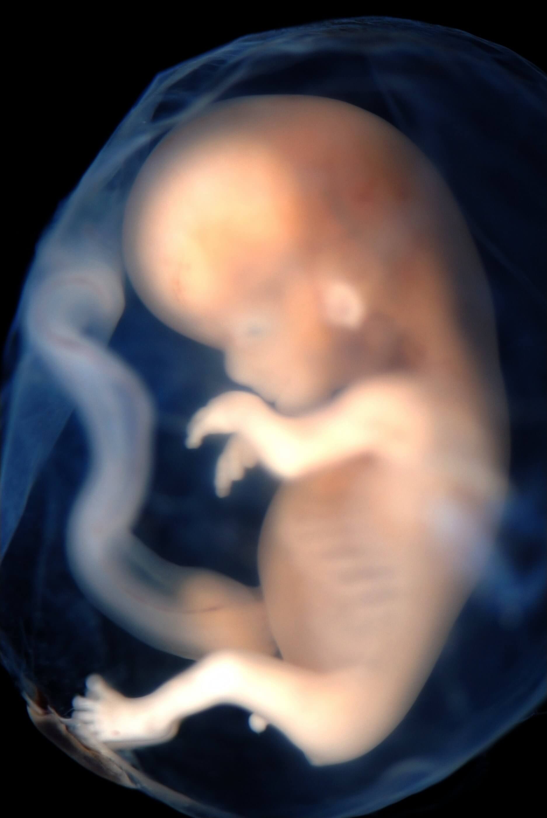 Baby Cris Human Embryo Development: Understanding the Miracle of Life