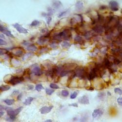 restricted fetal lung exlarge