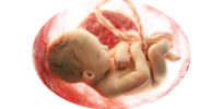 womb transplant