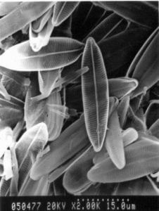 Diatom algae genetically engineered to destroy cancer cells