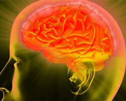 M Id brain