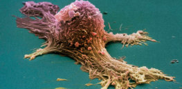 ovarian cancer cell sem steve gschmeissner