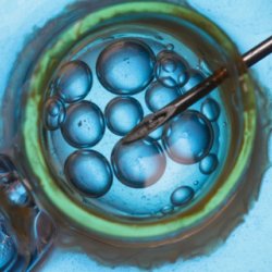 IVF and DNA injection via Shutterstock x