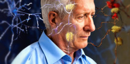 Alzheimer Negative Outlook