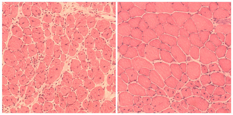 Impaired muscle repair in mice, left, compared with improved muscle regeneration seen after reprogramming. Credit: The Salk Institute for Biological Studies