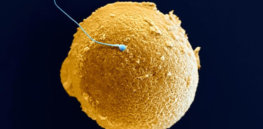 WEB P Fertilisation SEM SPL