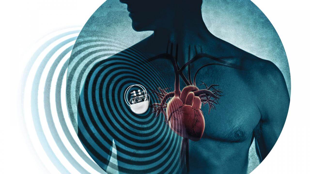 Pacemakers Made Out Of Human Stem Cells May Replace Electronic Models   Sn Pacemaker 0 