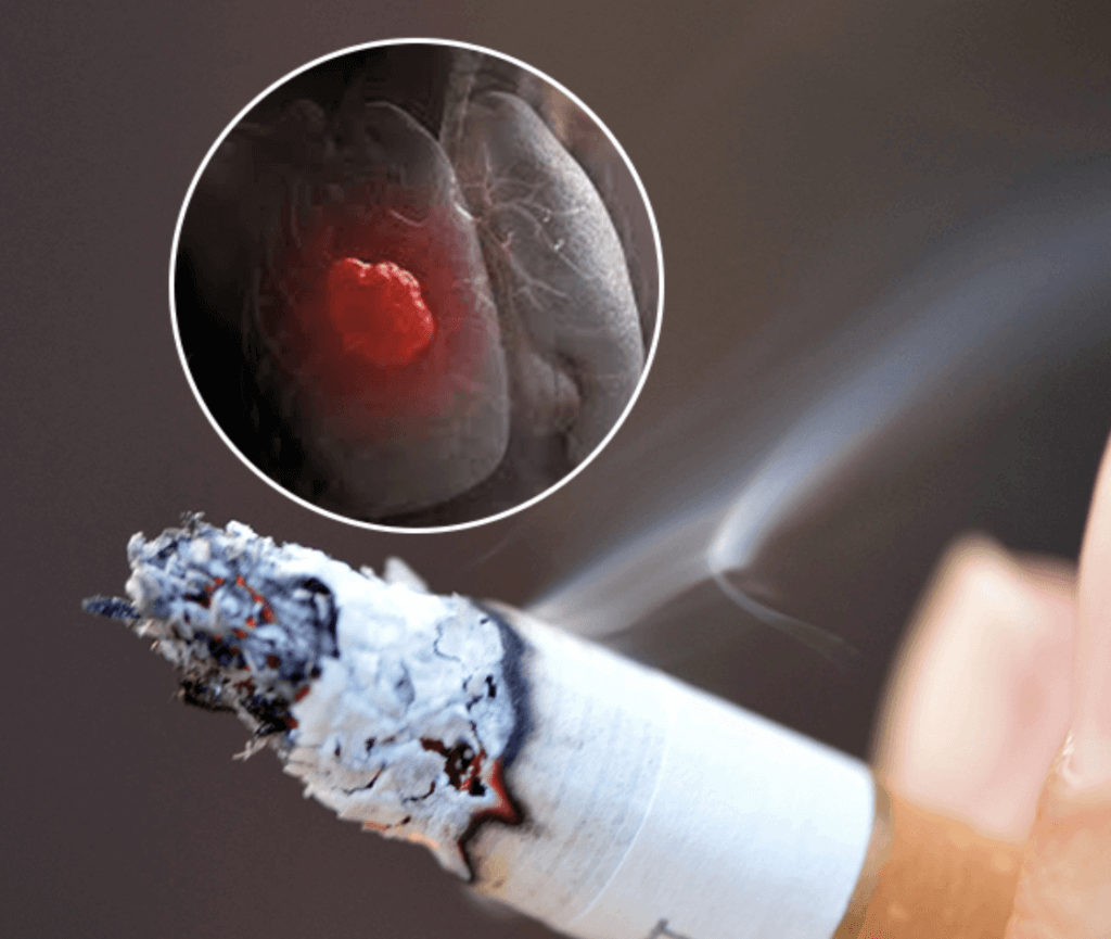 Unraveling science mystery of how smoking causes lung