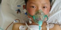 children heart disease radiation risks of cancer