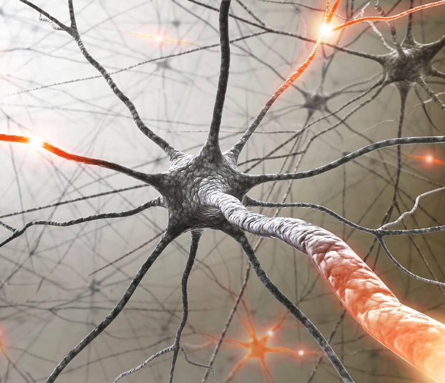 multiple sclerosis