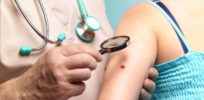 Personalized skin cancer vaccine shows promise