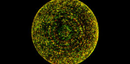 Lysosomes