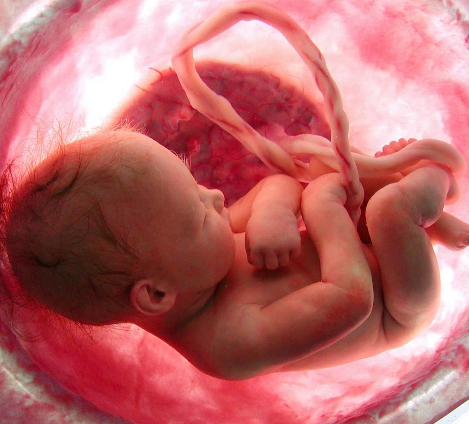 Why The Fetus A Foreign Body Does Not Attack Its Mother Genetic