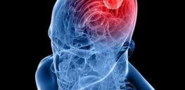 human brain with tumor