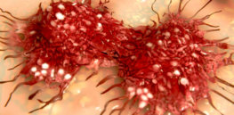 x Rare Subtypes of Ovarian Cancer