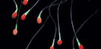 Sperm