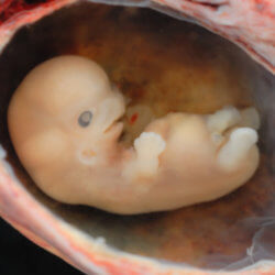 fetus
