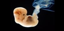 human embryo gty jt v x x