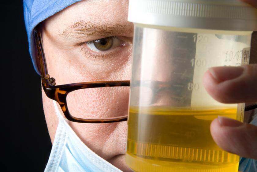 urine sample