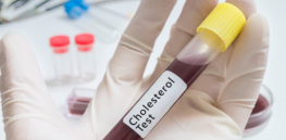 cholesterol test thinkstock