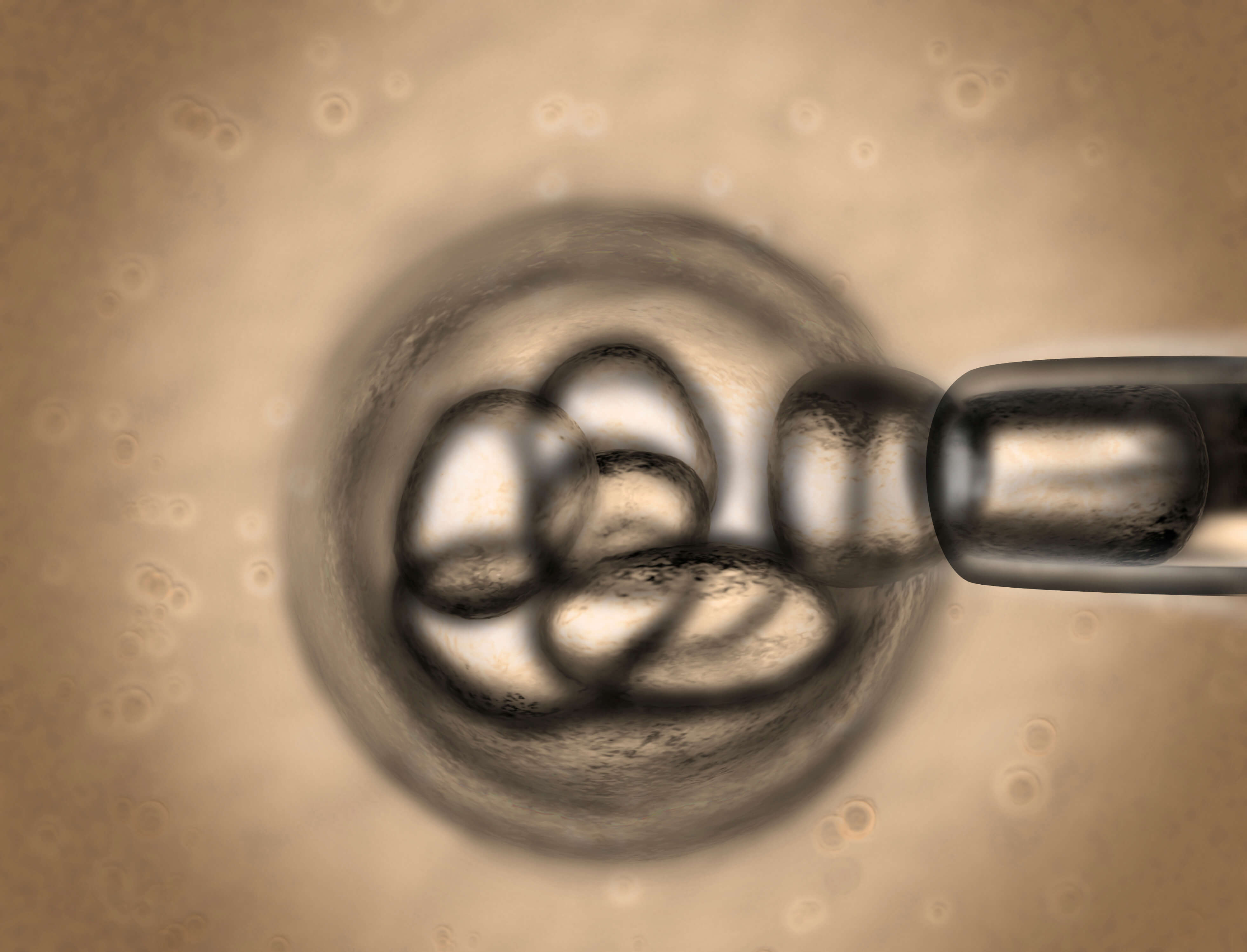 stem