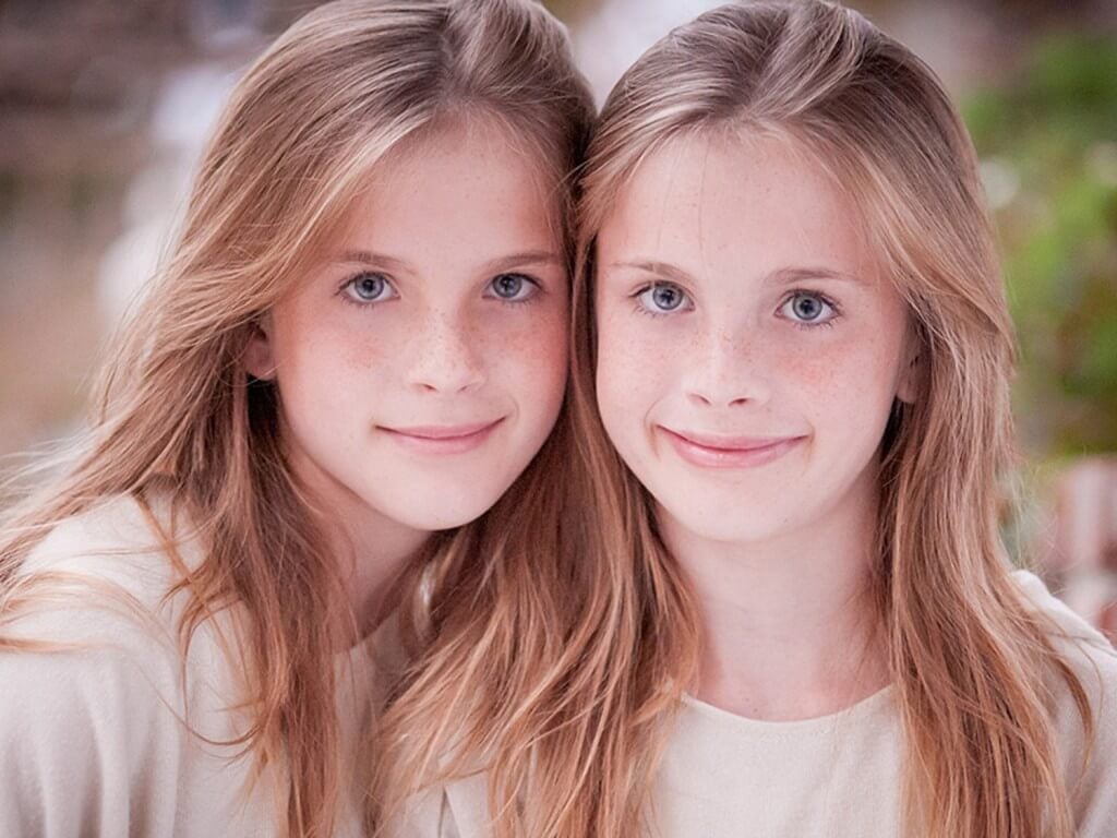 ‘Supersimilarity’: Identical twins are epigenetic twins as well ...