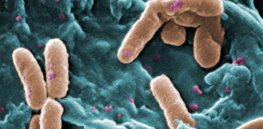 px Pseudomonas