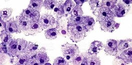 White blood cell warning system ‘sprays’ DNA to alert other cells
