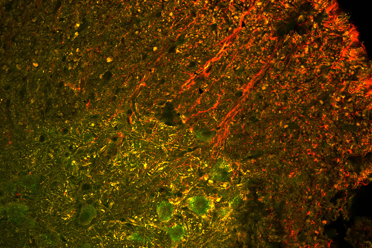 crispr