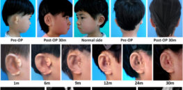 ears